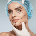 Plastic Surgery Treatments to Eliminate Cellulite